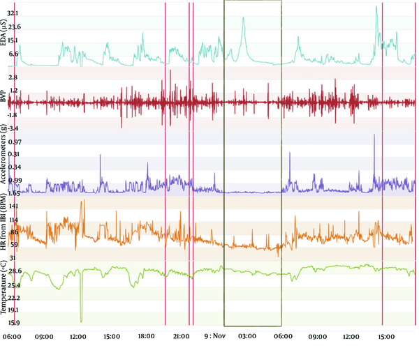 Vital sign monitoring during a sleep-wake cycle in a 46-year-old man. The figure depicts vital sign data obtained from an Empatica E4 wristband. The lines from top to bottom display electrodermal activity in microsiemens (µS), blood volume pressure from photoplethysmography, 3-axis acceleration from -2g to +2g, heart rate, temperature in degrees Celsius, and time and date. Red lines represent event marker. Black rectangle encompasses the sleep period detected by the analysis of the accelerometer curve, with practically no movement detected (flat line).