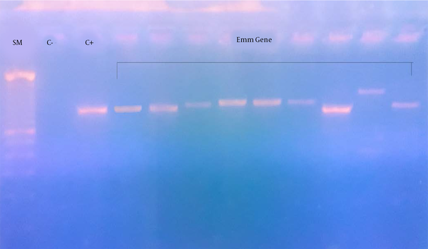 Polymerase chain reaction (PCR) amplification of M protein in group A Streptococcus (GAS). SM: DNA size marker, C-: negative control, C+: positive control Streptococcus pyogenes; Lanes 4-12, emm gene with the length ranging from 900 to 1400-bp.