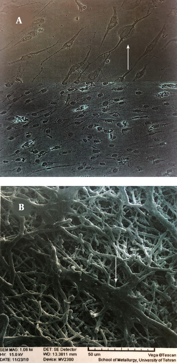 A, Optical image of neural cells differentiated from MSCs on the plate. B, SEM image of neural cells differentiated from MSCs on the P-PCL nano scaffold.