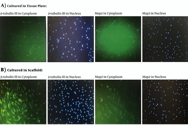 Fluorescence microscopic images of differentiated MSCs. A, The cells cultured on the plate after 15 days treatment with neural inducing medium, evaluated for β-tubulin III and Map2 genes expression. B, The cells cultured on the P-PCL nano scaffold after 15 days treatment with neural inducing medium, evaluated for β-tubulin III and Map2 genes expression. To detecting the neural cell's nuclei, co-staining by 4,6-diamidino-2-phenylindole (blue) was conducted.
