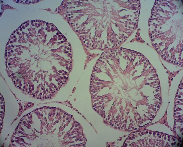 Photomicrograph of testicular tissue in the group receiving 0.4 mg/kg BW nano-selenium of old rat; magnification 100×, hematoxylin-eosin staining