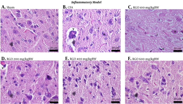 Histology of the spinal cords of mice under different treatment conditions in the inflammatory model of chronic pain. A, Sham; B, CFA; C, RGO 100; D, RGO 200; E, RGO 400; and F, RGO 600 mg/kg body weight (BW) are shown. Hematoxylin and eosin staining, 1,000× magnification. Labels: v, vacuolization; n, degenerating neuron; i, inflammatory cells. CFA, complete Freund’s adjuvant; RGO, red ginger oil.
