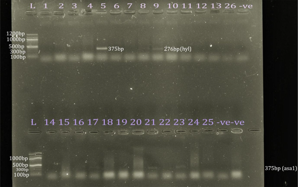 Detection of asa1 and hyl Genes in E. faecium and E. faecalis. Upper row: lane 1: 100 bp marker; lane 6: asa1 (375 bp); lane 10: hyl (276 bp); lane 16: negative control; lower row: lane 1: 100 bp marker; lanes 5, 9, and 11: asa1 (375 bp); lanes 14-15: negative control