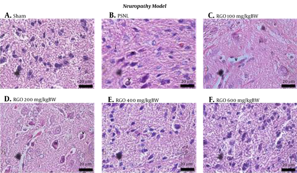 Histology of spinal cords of mice under different conditions in the neuropathy model of chronic pain. A, Sham; B, PSNL; C, RGO 100; D, RGO 200; E, RGO 400; and F, RGO 600 mg/kg body weight (BW) treatments are shown. Hematoxylin and eosin staining, 1,000× magnification. Labels: v, vacuolization; n, degenerating neuron; i, inflammatory cells. PSNL, partial sciatic nerve ligation; RGO, red ginger oil.