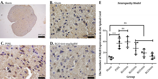 Immunohistochemical analysis of the expression of NMDA subunit NR2B in the spinal cords of mice in the neuropathy model of chronic pain. A, Sham at 100× magnification; B, Sham at 1,000× magnification; C, PSNL (1000× magnification); D, RGO 600 mg/kg body weight (BW) (1,000× magnification) are shown; E, NMDAR2B expression in spinal cord neurons (number ± SD; n = 4 mice). ns, not significantly different (P &gt; 0.05); ***, P &lt; 0.001 by one-way ANOVA followed by Tukey’s test. Linear regression between dose and NMDAR2B expression r2 value = 0.5917. PSNL, partial sciatic nerve ligation; RGO, red ginger oil.