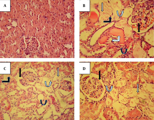 The effect of fucoidan on gentamicin-induced histopathological changes in the renal cortex stained with hematoxylin and eosin (× 400). Kidney photomicrograph in the control group shows interstitium; glomeruli and tubules are normal (A). Administration of 100 mg/kg/day gentamicin in the Gen group induced structural disturbances characterized by Bowman’s space enlargement (black arrow), severe proximal tubular injury (white arrow), acute tubular necrosis (black bent-up arrow), intratubular cast (white bent-up arrow), inflammatory cells (white curved-up arrow), and vascular congestion (black curved-up arrow) (B). Fucoidan treatment (C and D), especially at a dose of 50 mg/kg (Gen+F50), partially attenuated the glomerular and tubular damages.