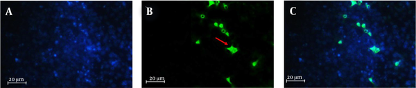 Fluorescence imaging of the cells marked with Map-2 antibody on the negative control after 14 days of culturing, (A) nuclei stained by DAPI, (B) primary antibody to MAP2, (C) merge, magnification:400×, Positive reaction: 16.4%.