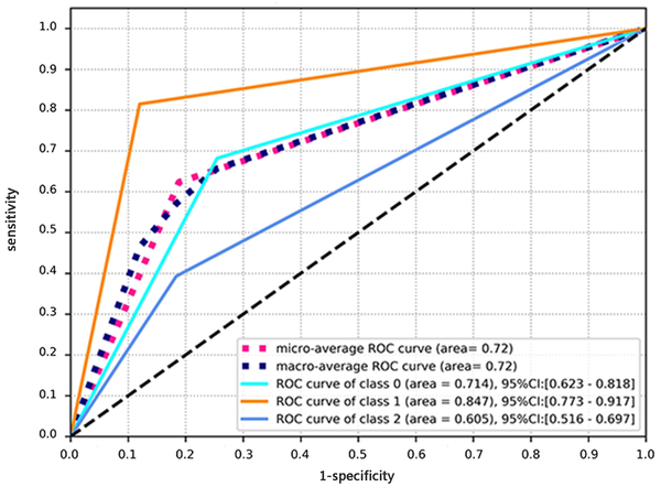 The receiver operating characteristic (ROC) curve for diagnosis of three diseases associated with left ventricular hypertrophy (LVH) based on the native T1 value. The micro-average ROC refers to the diagnostic ability of the multi-module model, calculated by the micro-average method. The macro-average ROC refers to the ROC curve analysis of the multi-module model, calculated by the macro-average method. Class 0 in the ROC curve analysis refers to the diagnostic ability of the multi-module model for hypertensive heart disease (HHD). Class 1 in the ROC curve analysis refers to the diagnostic ability of amyloid cardiomyopathy (AC) in the multi-module model. Class 2 in the ROC curve analysis refers to the diagnostic ability of the multi-module model for hypertrophic cardiomyopathy (HCM).