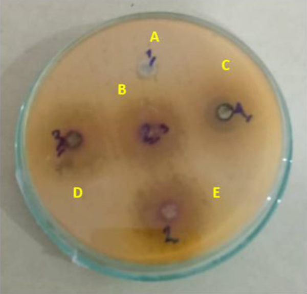 Diameter of the growth inhibition zone of ethyl acetate (A), methanolic (B), aqueous (C), hydroalcoholic (D), and ethanolic (E) extracts against Salmonella typhimurium