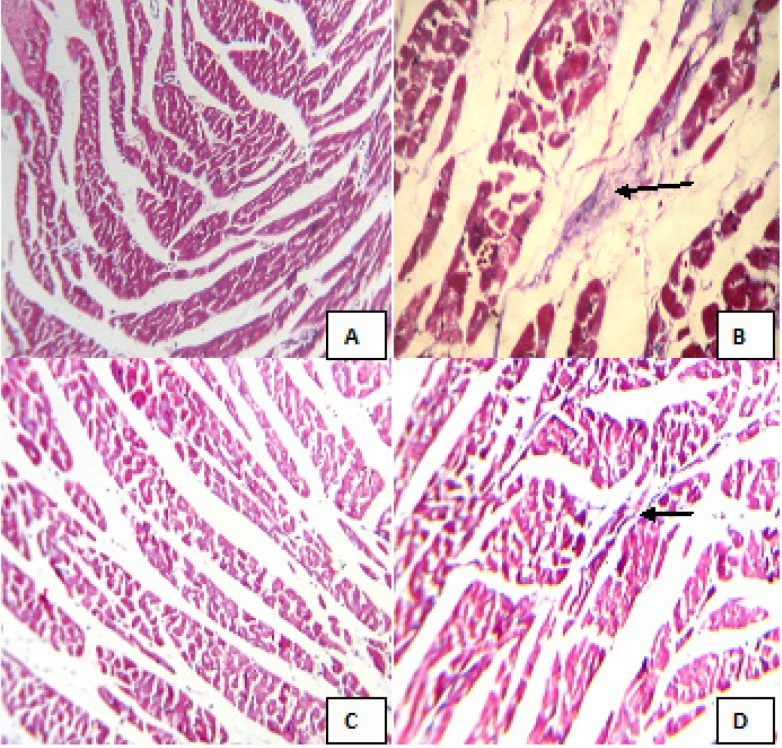 Ameliorative Effect of Beraprost Sodium on Celecoxib Induced ...