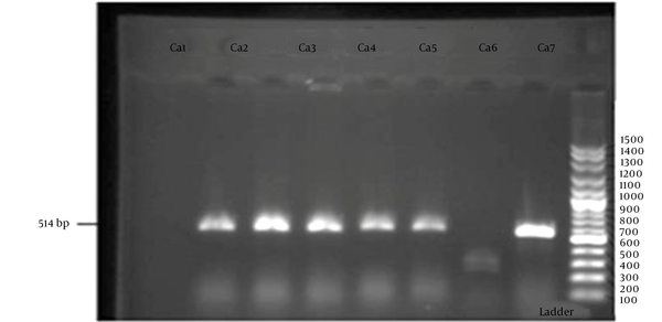 Agarose gel electrophoresis of fks1 gene profile for Candida albicans and Candida glabrata isolates; lanes: 1, 2, 3, 4, 5 ,7.