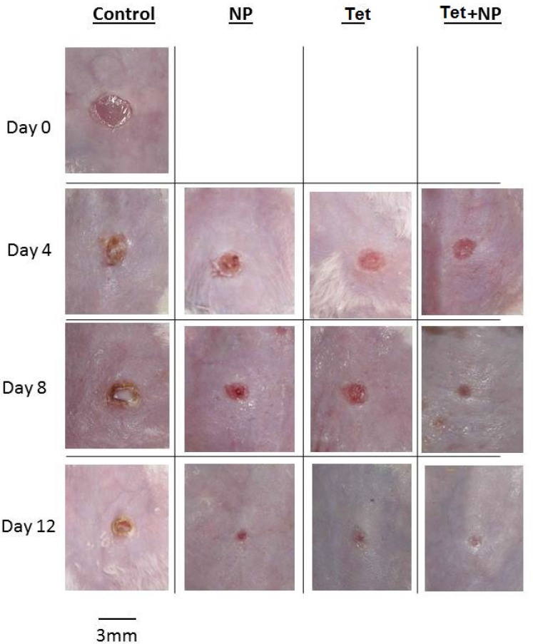 The Effect of Silver Nanoparticles on Wounds Contaminated with ...