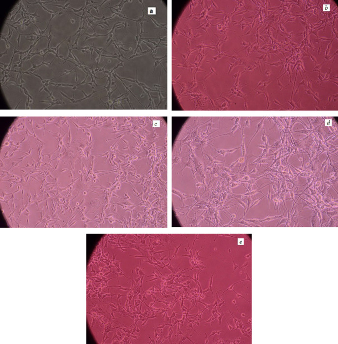 Lomustine Loaded Superparamagnetic Iron Oxide Nanoparticles Conjugated