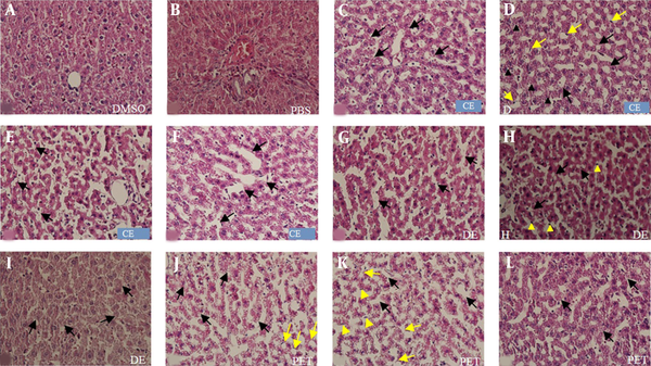 Photomicrographs of rat liver sections stained with H &amp; E (A-K) at 400× magnification. A shows the DMSO group and figure B the PBS group. Figures C-F show histopathological changes in the CE group; C, small vacuoles (black arrows); D, degeneration (yellow arrows), apoptosis (black arrows), and vacuolization of hepatocytes (black arrows); E, coalesced vacuoles (black arrows); F, dilated sinusoid (black arrows). Figures G-I show histopathological changes in the DE group; G, dilated sinusoid (black arrows); H, coalesced vacuoles (black arrows) and apoptosis (yellow arrowheads); I, degeneration (black arrows). Figures J and L show histopathological changes in the PE group; J, small vacuoles (black arrows) and vacuolization of hepatocytes (yellow arrows); K, dilated sinusoid (black arrows), apoptosis (yellow arrowheads), and ballooned hepatocytes (yellow arrows); L, degeneration (black arrows).