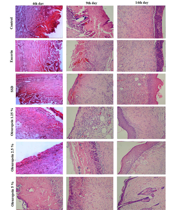 Histopathological observations of skin tissue stained with H &amp; E (magnification 40×) in different groups on the fourth, ninth, and fourteenth days of burns induction
