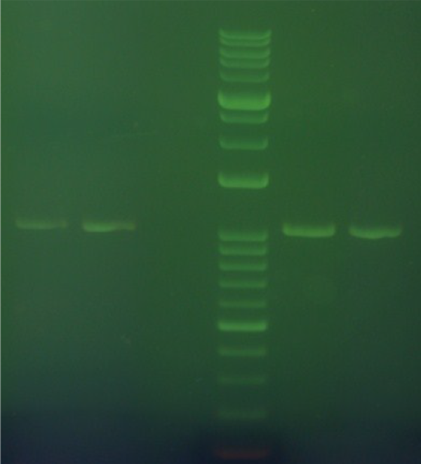 Electrophoresis of PCR products. PCR products of spike gene electrophoresed on 1% agarose gel.