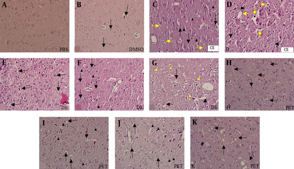 Photomicrographs of rat brain sections stained with H &amp; E (A-K) at 400× magnification. Figure A shows the PBS group and figure B, apoptosis (black arrows) in the DMSO group; C and D histopathological changes in the CE group; C, degeneration (black arrowheads), apoptosis (yellow arrows), and vacuolar spaces (black arrows); D, foamy cells (yellow arrows) and degenerate vacuolar cells (black arrows). Figures E-G show histopathological changes in the DE group; E, apoptosis of neuron (black arrows); F, apoptosis (black arrows) and degeneration (black arrowheads); G, foamy cells (black arrows) and vacuolar spaces (yellow arrowheads). Figures H-K show histopathological changes in the PE group; H and K, foamy cells (black arrows); I, vacuolar spaces (black arrows) and apoptosis (black arrowheads); J, cells without a nucleus (black arrowheads) and degenerated cells (black arrows).