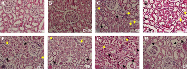 Photomicrographs of rat kidney sections stained with H &amp; E (AH) at 400× magnification. Figure A shows the PBS group and figure B DMSO group. Figures C and D show histopathological changes in the CE group; C, degeneration (black arrows) and necrosis (yellow arrows); D, atrophy (black arrows) and vacuolization (yellow arrows). Figures E and F show histopathological changes in the PE group; E, degeneration (black arrows) and vacuolization (yellow arrows); F, atrophy (black arrows) and necrosis (yellow arrows). Figures G and H show histopathological changes in the DE group; G, degeneration (black arrows), necrosis (yellow arrows), and vacuolization (black arrowheads); H, necrosis of tubular epithelium cells (black arrows) and glomerular congestion (black arrowheads).