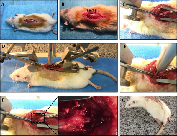 Spinal cord thoracic contusion model; (A) Anesthetize rat under ketamine and xylazine then hair was removed. A longitudinal midline dorsal incision was made after being sterilized with betadine; B - C, The T10-T11 lamina was removed to expose the spinal cord; D, The rat was placed under the device, and the spinal column was stabilized with forceps; E – F, Impact injury was performed by releasing the removable pin; G, Hind limp paralysis one day post injury was noted.