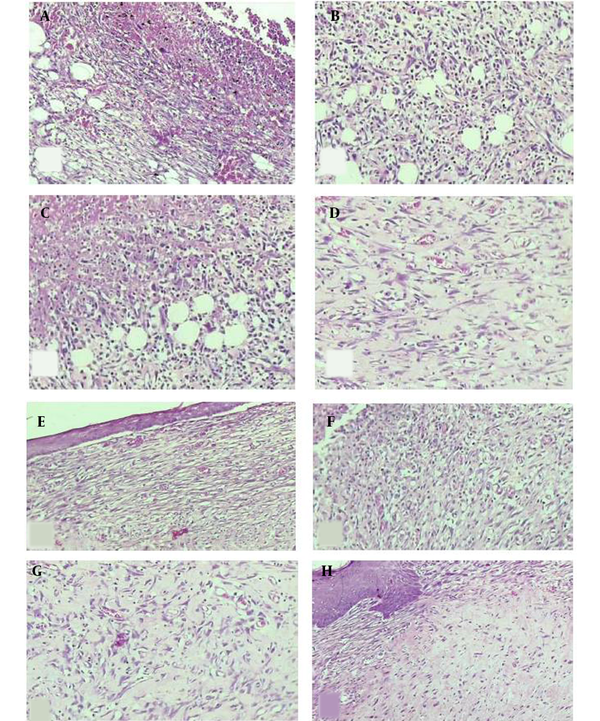 H &amp; E-stained slides showing the skin microscopic changes. On day 7 of sampling: The skin tissue with (A) moderate inflammation, moderate angiogenesis, and mild fibroplasia in the control group, (B) moderate inflammation, marked angiogenesis, and mild fibroplasia in the DC-treated group, (C) severe inflammation, moderate angiogenesis, and minimal fibroplasia in the magnet group, (D) mild inflammation, moderate angiogenesis, and moderate fibroplasia in the MDC group. On day 13 of sampling: The skin tissue with (E) mild inflammation, moderate angiogenesis, and mild fibroplasia in the control group, (F) moderate inflammation, marked angiogenesis, and mild to moderate fibroplasia in the DC-treated group, (G) mild inflammation, moderate angiogenesis, and fibroplasia in the magnet group, H) mild inflammation, moderate angiogenesis, and marked fibroplasia in the MDC group (100×).
