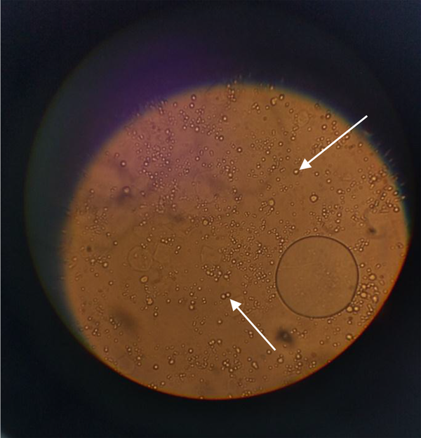 Oil droplets in the aqueous phase (40× magnification)