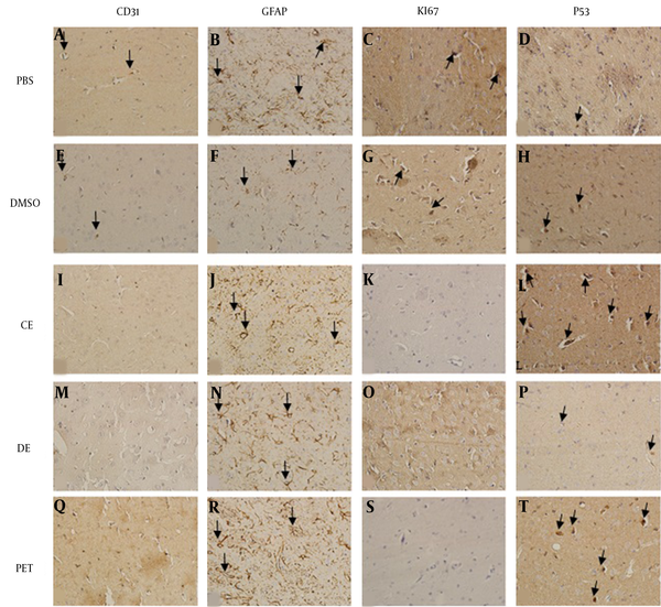 IHC photomicrographs of rat brain sections (A-T) at 400× magnification. Figures A-D show the expression of antibodies in the PBS group; A, CD31-positive cells (black arrows); B, GFAP-positive cells (black arrows); C, KI67-positive cells (black arrows); D, P53-positive cells (black arrows). Figures E-H show the expression of antibodies in the DMSO group; E, CD31-positive cells (black arrows); F, GFAP-positive cells (black arrows); G, KI67-positive cells (black arrows); H, P53-positive cells (black arrows). Figures I-L show the expression of antibodies in the CE group; I, without CD31-positive cells; J, GFAP-positive cells (black arrows); K, without KI67-positive cells; L, P53-positive cells (black arrows). Figures M-P show the expression of antibodies in the DE group; M, without CD31-positive cells; N, GFAP-positive cells (black arrows); O, without KI67-positive cells; P, P53-positive cells (black arrows). Q-T Q-T show the expression of antibodies in the PE group; Q, without CD31-positive cells; R: GFAP-positive cells (black arrows); S, without KI67-positive cells; T, P53-positive cells (black arrows).