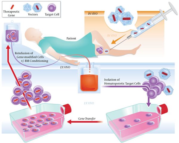 In vivo and ex vivo gene therapy concepts (2). In the in vivo technique, the therapeutic gene is introduced directly into the body, while in the ex vivo, the patient’s cells are extracted from the body, genetically modiﬁed outside the body, and then transferred into the patient.