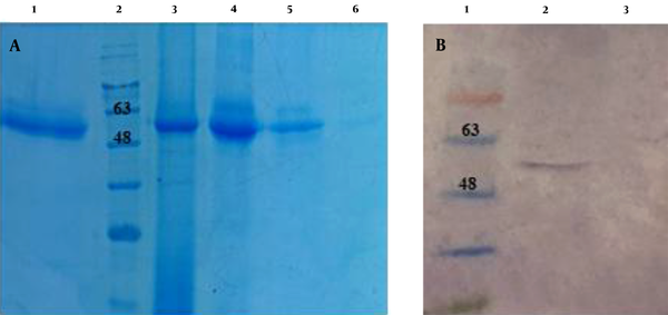 (A) SDS-PAGE of Ecarin protein. Lane 1: commercial Ecarin as control; Lane 2: protein size marker; Lanes 3-6: Ecarin purified fragment. (B) Confirmation of the expressed Ecarin by Western blot analysis. Lane 1 protein size marker; Lane 2: transfected cells containing pCAGGS- Ecarin; Lane 3: negative control (pCAGGS without Ecarin fragment).