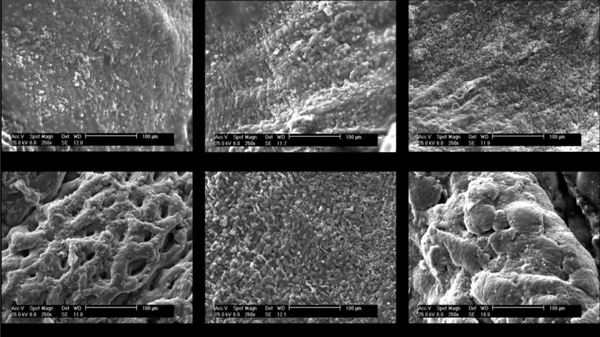 Scanning electron microscopy micrographs of the surface of injured peritoneum in various treatment groups 2 weeks after surgery. Polycaprolactone (PCL) and PCL-phosphatidylcholine (PCL-PC) films with and without drug were evaluated.