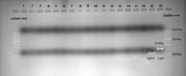 The results of PCR product on samples stained with electrophoresis gel; molecular marker (100 bp Cinnagen, Iran) (the first and last lanes), positive control of Plasmodium vivax (lane 17), positive control of Plasmodium falciparum (lane 18), negative samples (lanes 1-16)