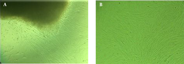 Morphological characteristics of mesenchymal stem cells isolated from Wharton’s jelly. A, primary culture after 10 - 14 days; cell buds’ growth from the sides of Wharton’s jelly tissue (magnification × 40); B, after the first passage, the cells, which resemble fibroblast cells with frills drawn around them, were stuck to the flask floor (magnification × 40).