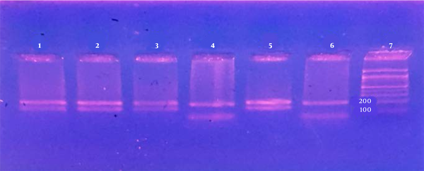 RFL) Patterns from Leishmania stock and patient samples using HaeIII Enzyme. Lanes 1, 2, 3, L. major; Lane 4, L. tropica; Lane 5, L. major as references strain; Lane 6, L. tropica as references strain; M, 100-bp size marker.