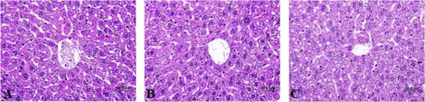 Histopathological evaluation of hepatic tissue without any toxic effect: (A) PBS, (B) Ecarin (200 μg/mL), (C) Ecamet (200 μg/mL); (Scale bar: 50 µm).