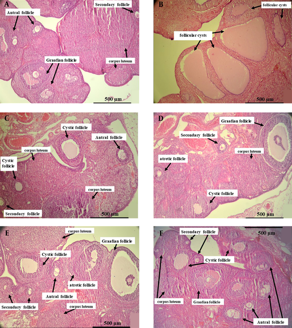 Photomicrographs of the elected ovarian cross-section from control, PCOS, metformin, and all doses of herbal syrup treated rats after 28 days of the experiment. (A) The control group with different stages of ovarian follicles, including secondary, antral, Graafian follicles, and corpora lutea. (B) The PCOS group with various giant cystic follicles. (C) The metformin group with secondary, antral, Graafian follicles, and corpora lutea. (D) The dose 1 group with small cystic follicles and other follicles. (E) The dose 2 group with mature Graafian follicles, small cystic follicles, other developing follicles, and corpora lutea. (F) The dose 3 group with lots of secondary and antral follicles and small cystic follicles (Hematoxylin and eosin staining, x10).