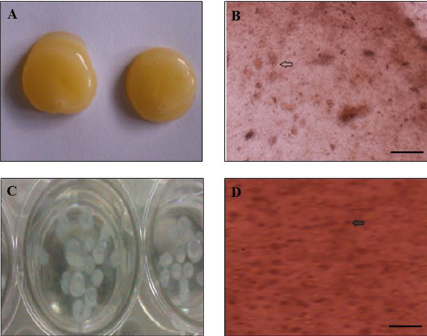 (A) Image of fibrin scaffold, (B) culture of h-ADSCs on the fibrin scaffold with an inverted microscope (× 100), (C) alginate beads, and (D) image of alginate beads with an inverted microscope (× 100)