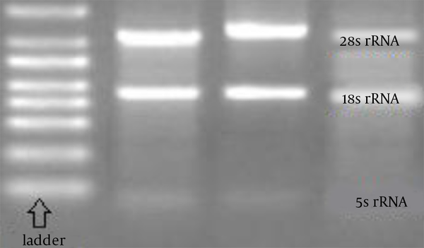 The extracted RNA quality of Wharton’s jelly-derived mesenchymal stem cells in the samples showed 2 bands belonging to 18S and 28S rRNAs (on 1.5% agarose gel containing safe stain).