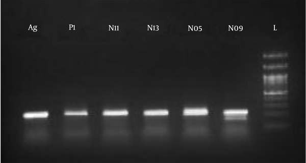 Banding patterns obtained from PCR electrophoresis of parent and hybrid strains; (Ag and Pl), parent strains; (N11, N13, N05, and N09), hybrid strains.