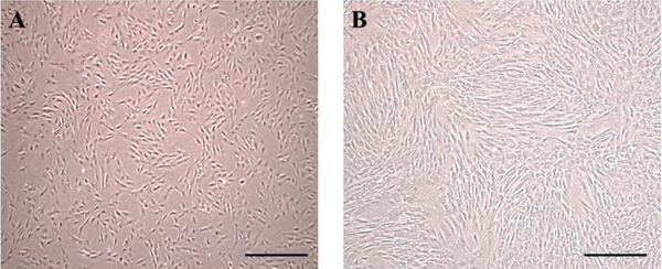 (A) Phase-contrast image of h-ADSCs in passage 3, (B) cells with 80 - 90% confluence; the morphological characteristics of cells exhibited a fibroblastic-like shape. Scale bars are a = 150 µm and b = 200 µm