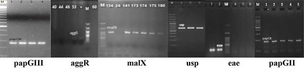 PCR reactions for virulence encoding genes of Escherichia coli in all strains (papGII, papGIII, usp, aggR, eae, malX were positive), (bfp, stx1, stx2, cnf, afa-Dr, cdt, ibeA  papGII were negative); M: Ladder 1000 bp; papGIII, 258 bp; aggR, 254 bp; malX, 930 bp; usp, 615 bp; eae, 167 bp; papGII, 190 bp.