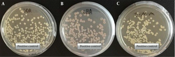 Morphological characteristics of pure colonies of C. auris (MZ389242) white to cream on Sabouraud dextrose agar (A), pink on CHROMagar upon 2 days of incubation at 35°C (B), white to cream on Salt Sabouraud dextrose agar upon 7 days of incubation at 40°C (C) (5).