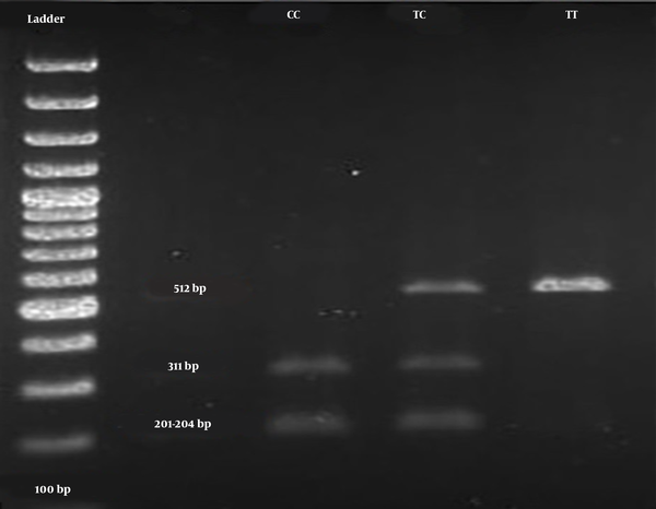 Image of 2% agarose gel after digestion with the restriction enzyme TaqI and amplification with specific primers; representative electrophoresis results of wild homozygote TT (512 bp), heterozygote TC (512, 311, 201 - 204 bp), and mutant homozygote CC (311, 201 - 204 bp)
