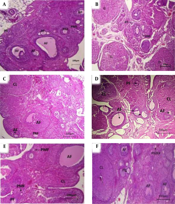 Histological examination of ovarian tissue [hematoxylin and eosin (H&amp;E, 40X magnification)]; A and B: Ovarian sections in prenatally gal-exposed rats and controls, respectively (45 - 50 days of age); C and D: Ovarian sections in prenatally gal-exposed rats and controls, respectively (105 - 110 days of age); E and F: Ovarian sections in prenatally gal-exposed rats and controls, respectively (180 - 185 days of age). PF, primary follicle; PMF, primordial follicle; AF, antral follicle; PAF, preantral follicle; ATF, atretic follicle; CL, corpus luteum.