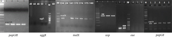 PCR reactions for virulence encoding genes of Escherichia coli in all strains (papGII, papGIII, usp, aggR, eae, malX were positive), (bfp, stx1, stx2, cnf, afa-Dr, cdt, ibeA, papGII were negative); M: Ladder 1000 bp; papGIII, 258 bp; aggR, 254 bp; malX, 930 bp; usp, 615 bp; eae, 167 bp; papGII, 190 bp.