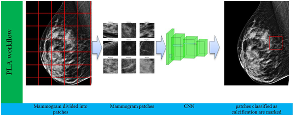 The mammogram is first divided into patches with a size of 224 × 224 pixels. Next, each patch is separately fed into the convolutional neural network (CNN) for classification. The CNN classifies each patch into either normal or calcification. Finally, patches classified as calcification are marked.