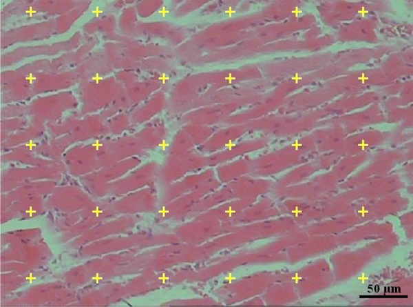 The method of point-counting for determining the volume of the myocardium and the number of points hitting the structure The method of point-counting for determining the volume of the myocardium and the number of points hitting the structure