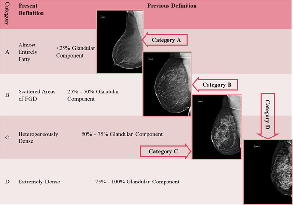 Categories of breast tissue composition in mammography (MG), old relevant descriptors based on the percentage of glandular tissue, and right mediolateral oblique view of the corresponding mammograms (FGD, Fibroglandular density).