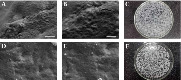 The SEM images of TPP–cross-linked FMT/CH (A and C); MMT-FMT/CH bio-nanocomposite hydrogels (B and D); and the digital images of MMT-FMT/CH bio-nanocomposite hydrogels [wet (e) and dry (f)]