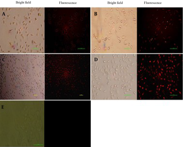 Fluorescence microscopy bioimaging of uptake of N, S, P, B-codoped carbon dots (100 µg/mL) on the MCF-7 cancer cell at different time intervals of (A) 4 hours, (B) 6 hours, (C) 12 hours, (D) 24 hours, and (E) control (Scale Bar = 100 µm)