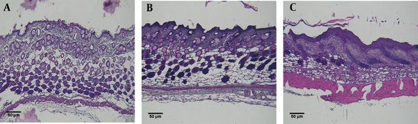 Histopathological results of mouse back skin tissues in A, untreated healthy control mice; B, mice treated with a mixture of acetone/olive oil; C, and irritant contact dermatitis (ICD) mice treated with a mixture of dinitrochlorobenzene (DNCB) and acetone/olive oil. Dorsal skin sections were stained with H&amp;E (Scale bars = 50 μm).