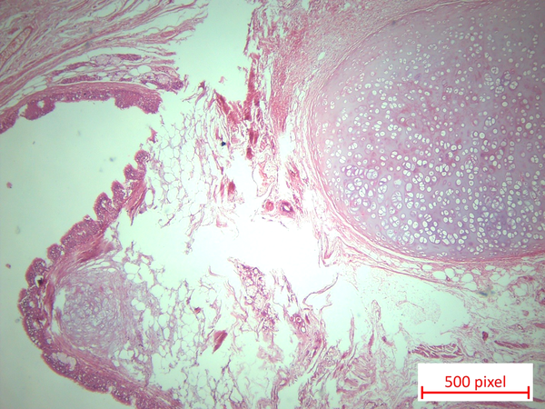Hematoxylin and eosin-stained sections (x4) showing mature cartilaginous tissue, lumens lined by ciliated columnar epithelium, mucinous salivary gland, adipose tissue, and smooth muscles